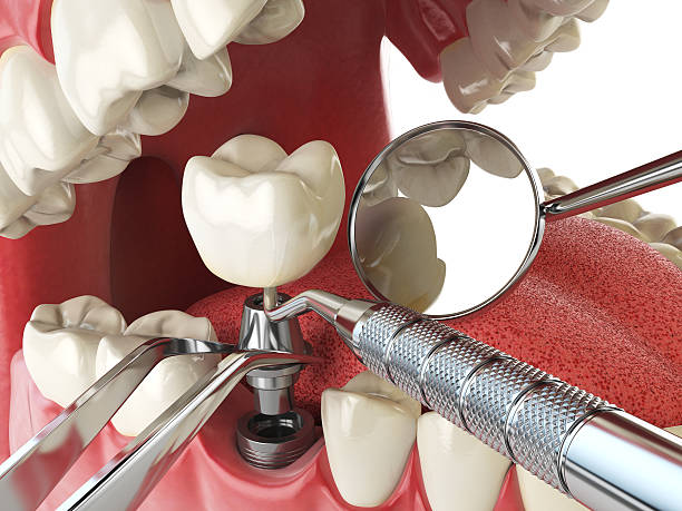 Best Walk-In Emergency Dental Services in West Point, UT